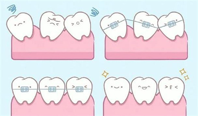 上海伟德口腔门诊可以用医保吗？真实案例分享＋新价格表