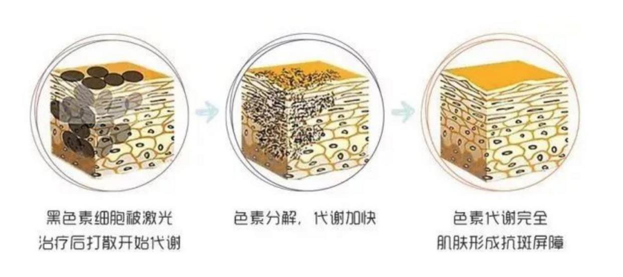 广州积美整形医院激光美容价格多少?全新标准出炉!附医生简介