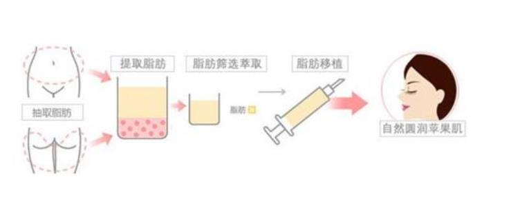 苹果肌断层有啥办法解决？断层的原因有这两点！