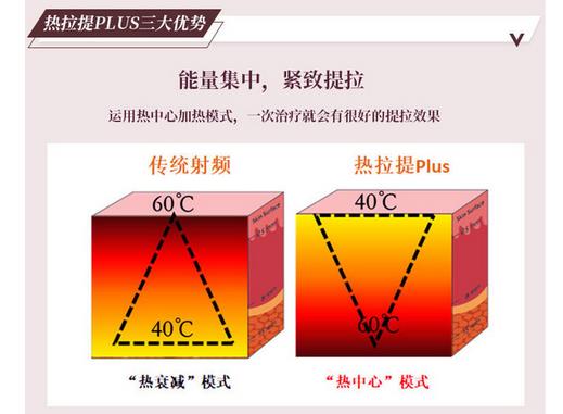 热拉提做几次有效果？一次多少钱？面部提升必看攻略~