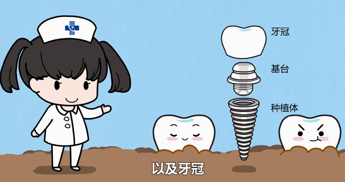 上海天使齿科种植牙价格表曝光！田杰和赵百良谁的技术好？手术对比照