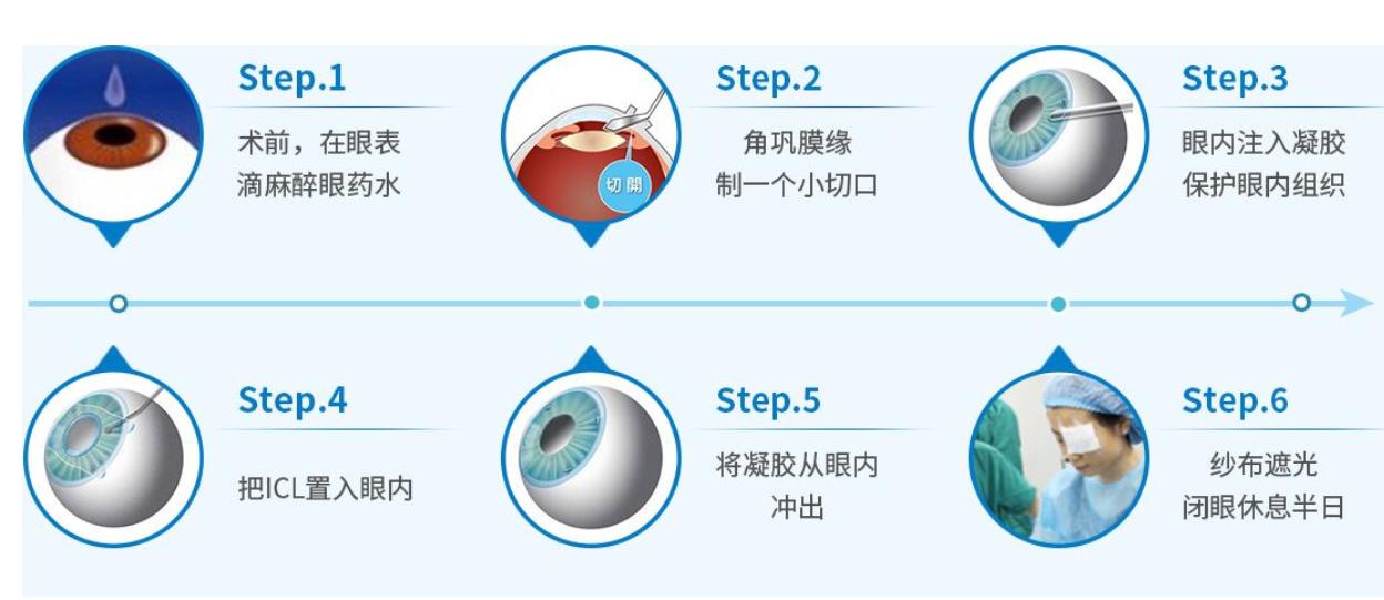 北京近视手术大概多少费用？价格明细_飞秒\晶状体植入介绍