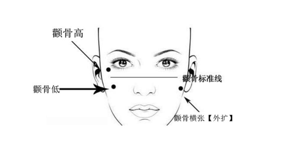 张笑天颧骨内推案例_医生个人简介！脸型微调必看~