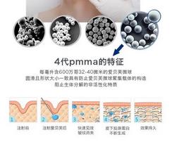 爱贝芙玻尿酸多少钱一支？1k-1.5k左右，维持时间解析！