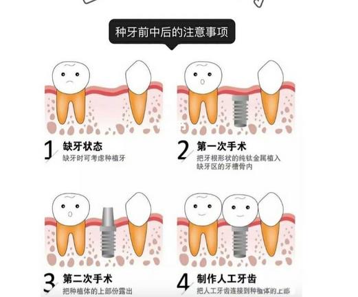 北京美特思口腔诊所怎么样_口碑简介_种植牙案例_价目表