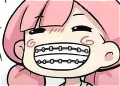 上海摩尔星洲口腔正畸多少钱？收费贵吗？价格表分享！