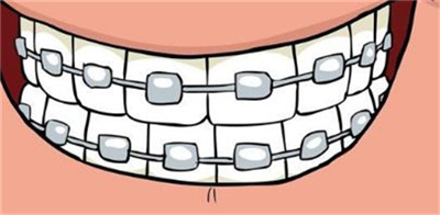 牙博士正畸水平如何？附正畸案例！2023年价目表更新！
