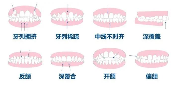 上海妙寅口腔门诊部口碑好不好？真人做牙齿矫正图介绍！