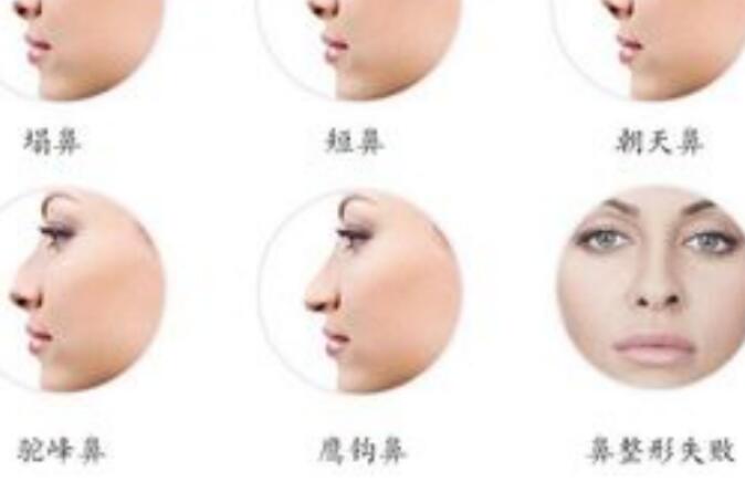 隆鼻手术好吗，可行性和效果！