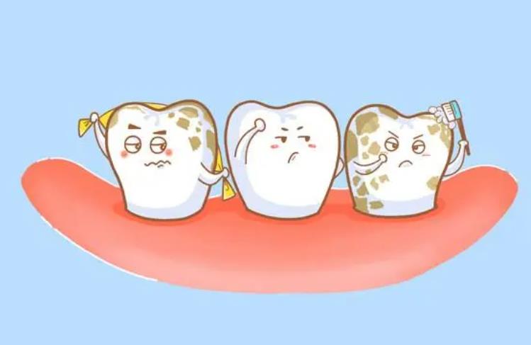 众植齿科医院怎么样？真人做牙齿美白的过程图介绍！来看对比照