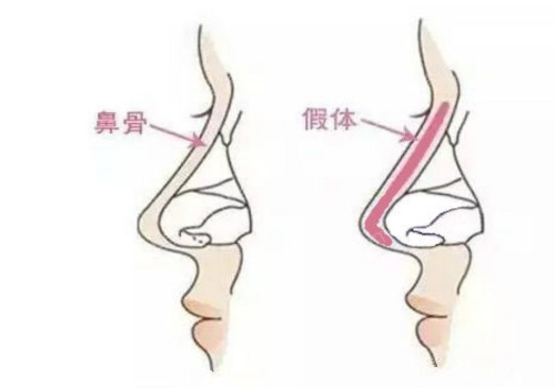 杨凌飞医生案例参考！给医生技术疯狂打call