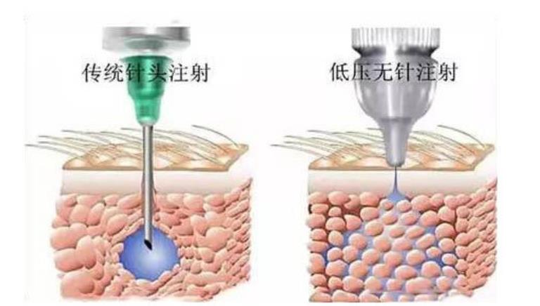 上海瑟芙医疗美容门诊部抗衰价格多少？真人做抗衰案例分享