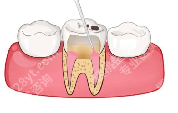 上海雅适美口腔医院根管调节技术靠谱吗？医院简介|网友亲身经历分享！