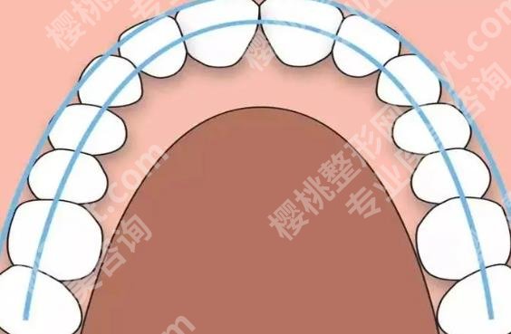 思迈尔口腔医院怎么样？陈克芹医生擅长项目有哪些？技术好不好