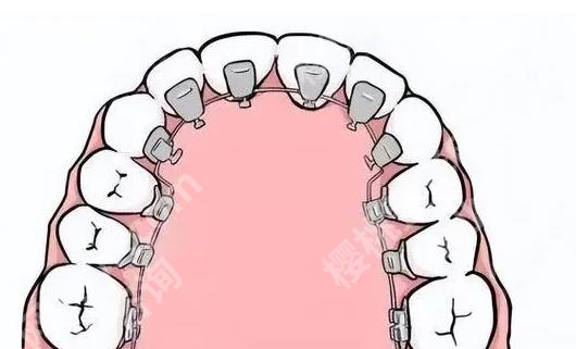 上海一番口腔门诊部正畸价格贵不贵？张建中医生资料|牙齿矫正效果图