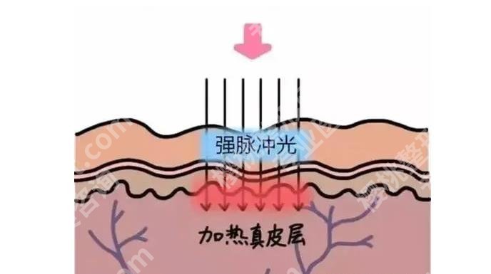 上海星璨门诊部怎么样？资料简介、口碑实力公布！附嫩肤案例