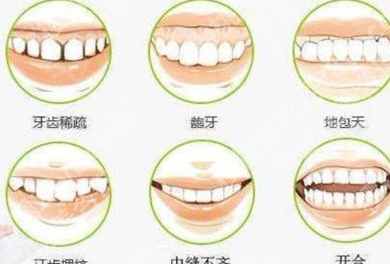 上海智星口腔门诊部正畸多少钱？医院特色项目及地址介绍