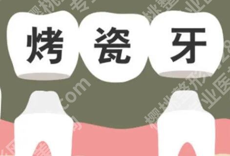 烤瓷牙如何安装固定？牙齿的位置、形状和颜色等方面可以了解！