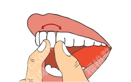 烤瓷牙如何安装固定？牙齿的位置、形状和颜色等方面可以了解！