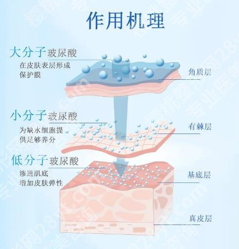 玻尿酸填充下巴有什么副作用？内附玻尿酸信息