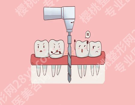 现在种一颗牙要多少钱一颗？因地区、医院及患者的具体情况而有所不同！