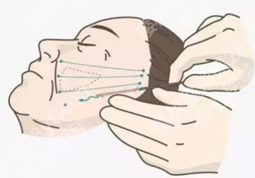 皮肤松弛怎么办如何变紧致面部？这些方法都适用于不同人群