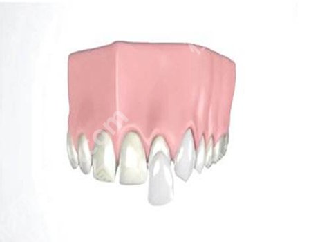 一般的全瓷牙价格一颗？全瓷牙是美观且耐用的修复牙齿的方式！
