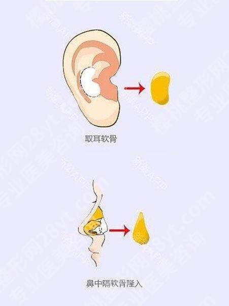 合肥安医做鼻子怎么样？安徽医科大学第一附属医院整形外科简介