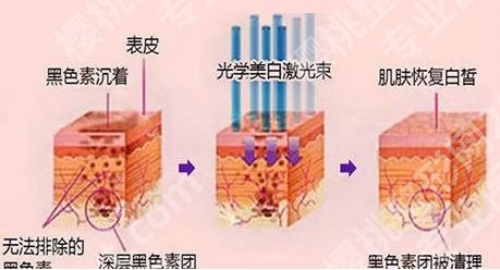 皮肤暗黄怎么改良变白？比较有用的调理方法介绍！