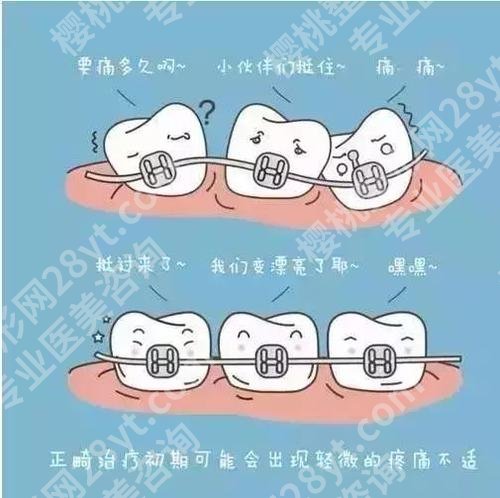 这5类人不能做牙齿整形！教你牙齿整形如何选择医院