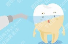 洗牙对牙齿有损害吗？洗牙原理、好处等分享！