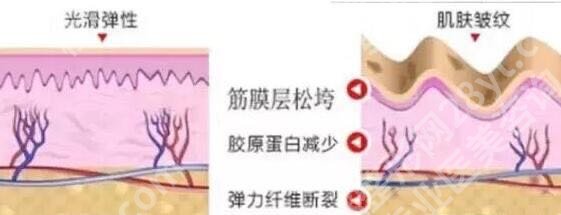 热玛吉一次多少钱？价格费用明细、功效作用揭晓！