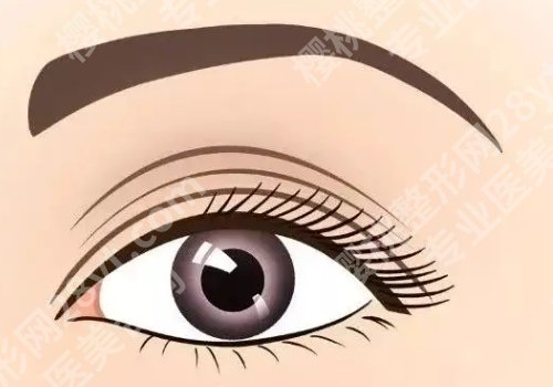 双眼皮埋线能维持多久？手术的注意事项有哪些?
