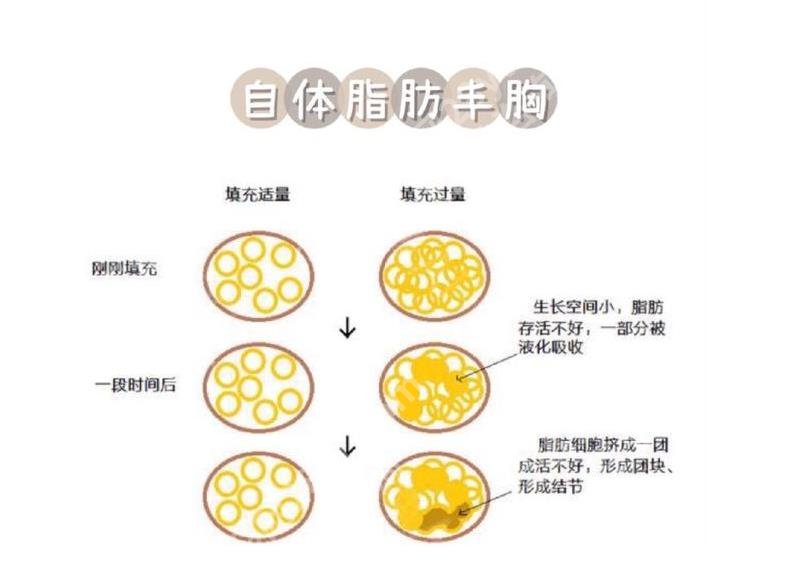 林华芬医生口碑怎么样？上海艺星好评专家资料公开！