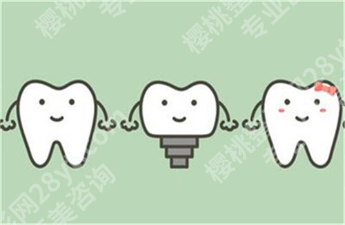 北京地坛口腔门诊部种植牙价格表？人气医生介绍