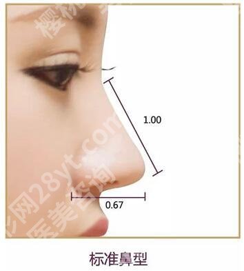 王志坚医生鼻子案例:假体隆鼻术后3个月反馈！附手术价格
