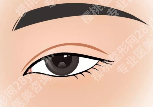 北京联合丽格双眼皮价格是多少？内附医生资料！