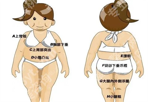 北京樱桃医疗美容腿部吸脂怎么样？案例来袭，看术后改变