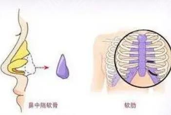 柳春明医生怎么样？怎么预约挂号？医生资料、肋骨隆鼻案例分享！