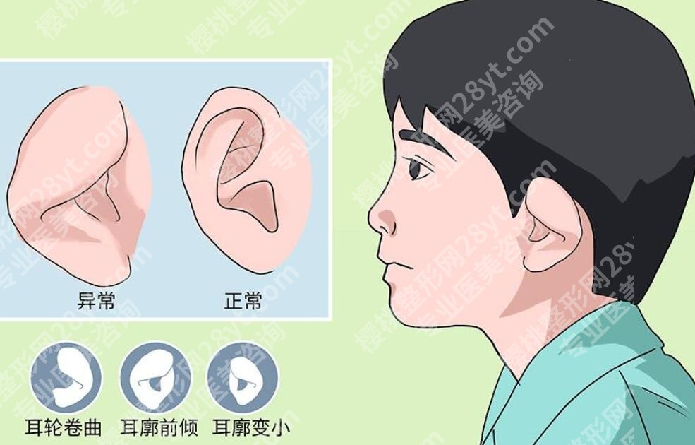 北京八大处小耳畸形手术费用是多少？医院信息|坐诊专家名单公布！