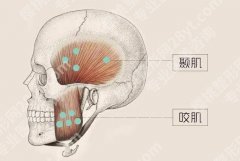 咬肌发达怎么办？怎么瘦下来？注射瘦脸挺有用！
