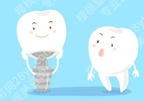 成都种植牙案例，手术过程详细讲解！
