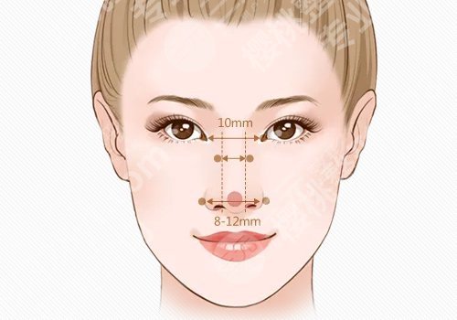 温州假体隆鼻要多少钱?术后两个月鼻子情况？