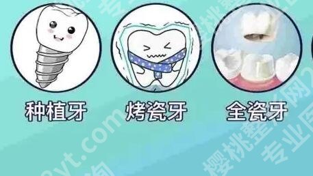 西安种植牙好的医院排名？上榜医院个个都是实力派!