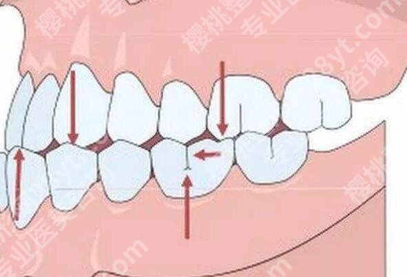 北京英迪口腔门诊部正畸怎么样？医院简介|真人正畸案例预览！