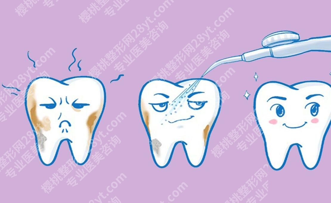 北京牙管家口腔诊所怎么样？医院口碑评价|洗牙案例预览！