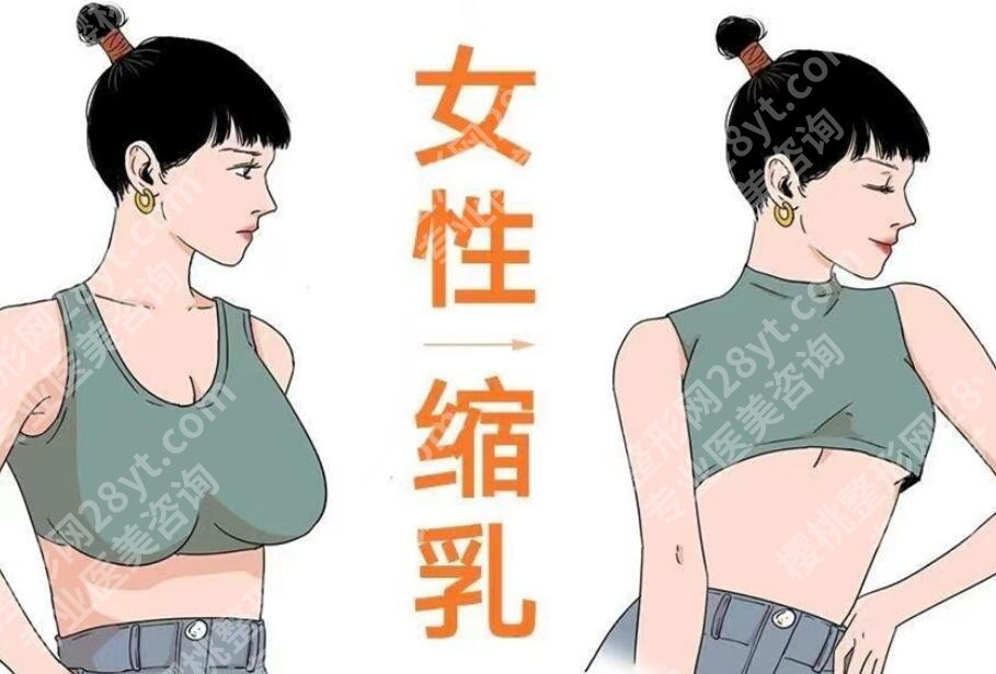 南京缩胸手术案例图分享！来看看前后差别大不大吧！