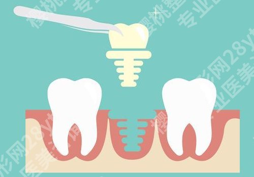 北京维恩口腔门诊部种植牙怎么样？内附医生信息介绍！