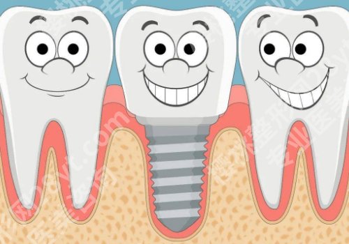 北京中诺口腔医院牙齿种植价格更新来袭，内附医院医生资料一览