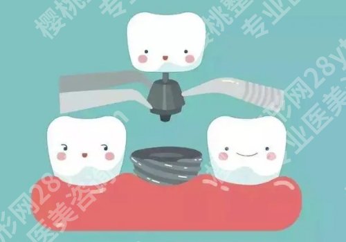 北京盖德口腔门诊部种植牙价格是多少?费用明细及医生介绍一览